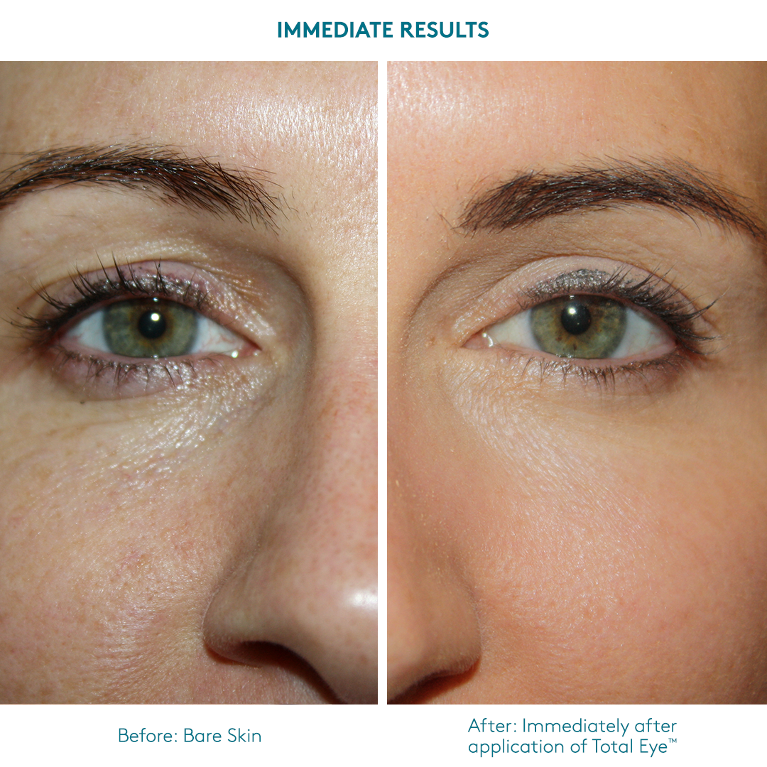 Colorescience Total Eye Spf 35 - before and after