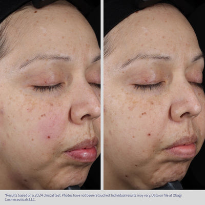 Obagi Medical Moisture Restore Cream - Nyhet!