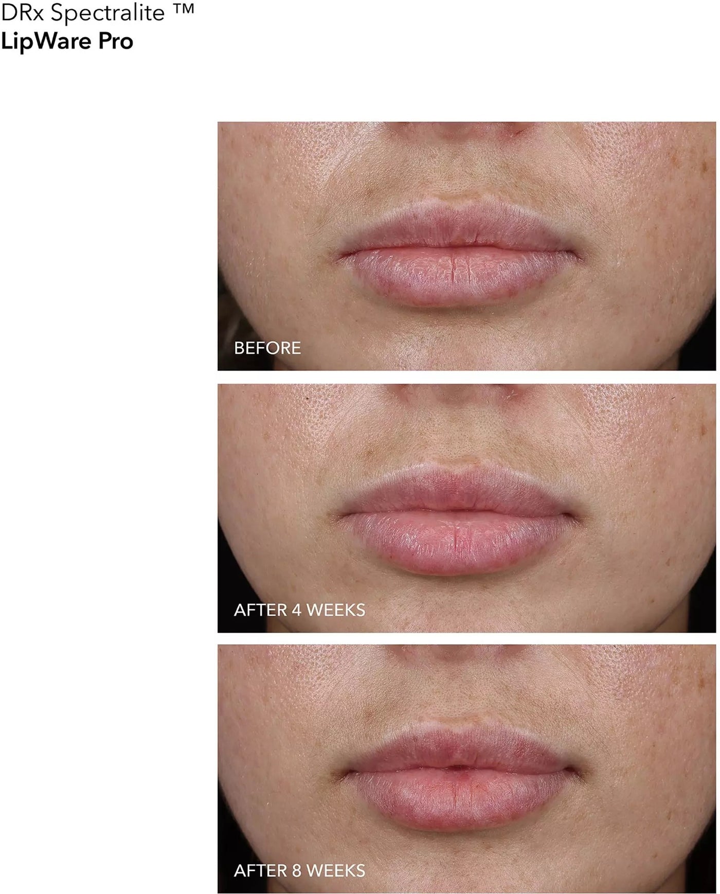Dr.Dennis Gross Skincare DRx Spectralite LipWare PRO