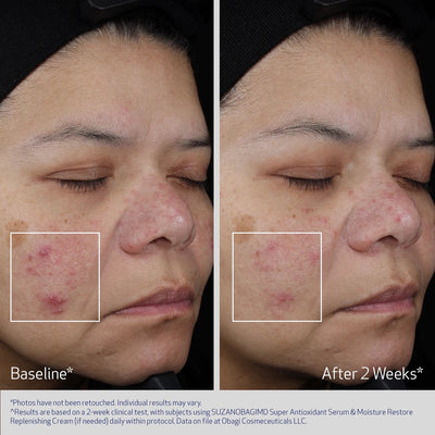 Obagi Medical Super Antioksidant Serum - Nyhet!