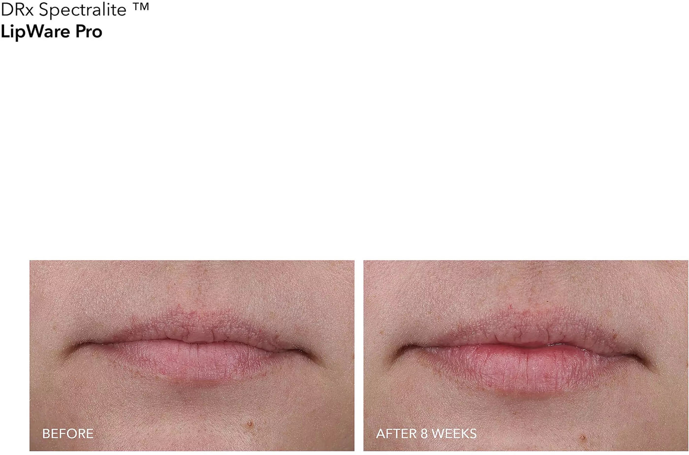 Dr.Dennis Gross Skincare DRx Spectralite LipWare PRO