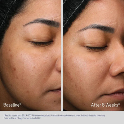 Obagi Medical  Retinol +PHA Refining Night Cream - Nyhet!