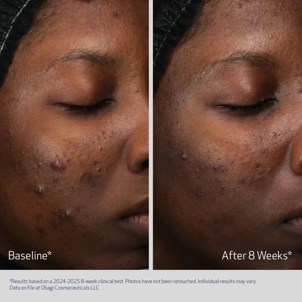 Obagi Medical  Retinol +PHA Refining Night Cream - Nyhet!