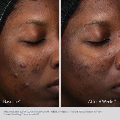 Obagi Medical  Retinol +PHA Refining Night Cream - Nyhet!