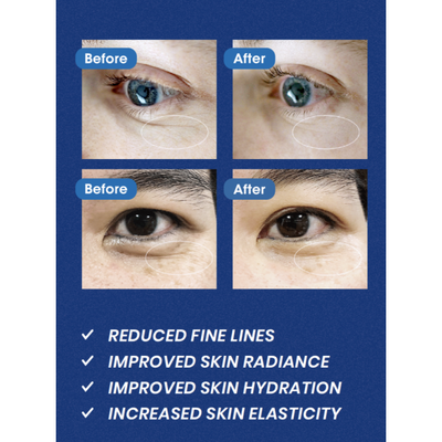 Infracyte Illumin-eyes Micro Filler Patch